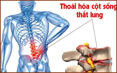 Thoai Hoa Cot Song Lung