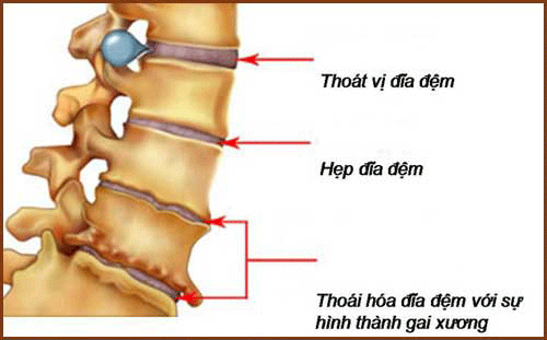 Thoat Vi Dia Dem